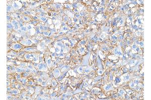 Immunohistochemistry (IHC) image for anti-CD44 (CD44) (AA 692-742) antibody (ABIN7453578) (CD44 antibody  (AA 692-742))