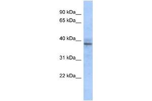 WB Suggested Anti-ZNF625 Antibody Titration:  0. (ZNF625 antibody  (N-Term))