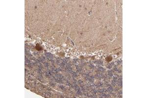 Immunohistochemical staining of human cerebellum with ZFYVE1 polyclonal antibody  shows moderate cytoplasmic positivity in purkinje cells at 1:50- 1:200 dilution. (ZFYVE1 antibody)