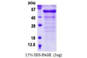Image no. 1 for FGFR1 Oncogene Partner (FGFR1OP) protein (His tag) (ABIN1098628) (FGFR1OP Protein (His tag))