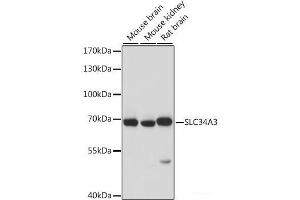 SLC34A3 antibody