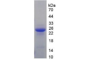 SDS-PAGE analysis of Mouse DBP Protein. (Vitamin D-Binding Protein Protein (GC))
