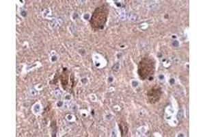 Immunohistochemistry of CDIP in mouse brain tissue with CDIP antibody at 2. (CDIP1 antibody  (Center))