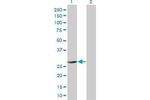 Western Blot analysis of FCER1A expression in transfected 293T cell line by FCER1A MaxPab polyclonal antibody.