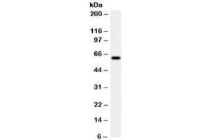 Western blot testing of HeLa cell lysate with HSP60 antibody (clone LK2). (HSPD1 antibody)