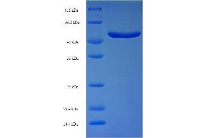 SDS-PAGE (SDS) image for Fibronectin Type III and Ankyrin Repeat Domains 1 (FANK1) (AA 1-345), (full length) protein (His-SUMO Tag) (ABIN5711521)