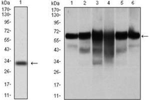 Western Blotting (WB) image for anti-Keratin 5 (KRT5) antibody (ABIN1106933) (Cytokeratin 5 antibody)