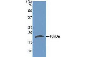 Detection of Recombinant CLC, Human using Polyclonal Antibody to Charcot Leyden Crystal Protein (CLC) (Galectin 10 antibody  (AA 2-142))