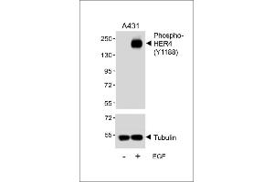 Western blot analysis of lysates from A431 cell line, untreated or treated with EGF, 100 ng/mL, using Phospho-HER4 Antibody (upper) or tubulin (lower). (ERBB4 antibody  (pTyr1188))