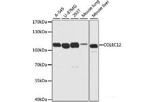 Western blot analysis of extracts of various cell lines using COLEC12 Polyclonal Antibody at dilution of 1:2000. (COLEC12 antibody)