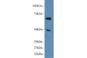 Detection of CD15 in Human Jurkat cell lysate using Polyclonal Antibody to Cluster Of Differentiation 15 (CD15) (CD15 antibody  (AA 144-389))