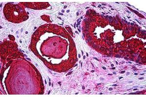 Anti-KLK3 / PSA antibody IHC staining of human prostate. (Prostate Specific Antigen antibody)
