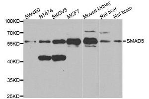 Western blot analysis of extracts of various cell lines, using SMAD5 antibody. (SMAD5 antibody  (AA 186-465))
