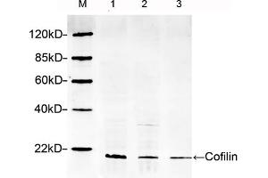 Lane 1: Hela lysateLane 2: HEK293 lysateLane 3: NIH/3T3 lysateWestern blot analysis cell lysates using 1 µg/mL Rabbit Anti-Cofilin Polyclonal Antibody (ABIN398791) The signal was developed with IRDyeTM 800 Conjugated Goat Anti-Rabbit IgG. (Cofilin antibody  (AA 100-150))