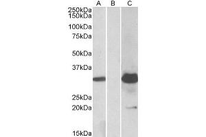 HEK293 lysate (10ug protein in RIPA buffer) overexpressing Human KCTD11 with DYKDDDDK tag probed with ABIN2563535 (1. (KCTD11 antibody  (Internal Region))