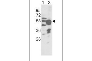 Western blot analysis of CYP2R1 Antibody (Center) (ABIN392380 and ABIN2842012) in NCI- cell line(lane 1) and mouse liver tissue(lane 2) lysates (35 μg/lane).