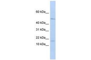 Image no. 1 for anti-Pre-B Lymphocyte 1 (VPREB1) (AA 36-85) antibody (ABIN6740759) (VPREB1 antibody  (AA 36-85))