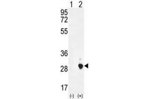 Western blot analysis of CSH1 (arrow) using rabbit polyclonal CSH1 Antibody (C-term) . (CSH1 antibody  (C-Term))