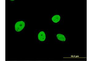 Immunofluorescence of monoclonal antibody to NOL4 on HeLa cell. (NOL4 antibody  (AA 425-524))