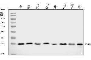 Western blot analysis of Proteasome 20S Beta 7/PSMB7 using anti-Proteasome 20S Beta 7/PSMB7 antibody (ABIN7600256).