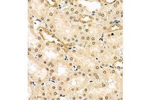 Immunohistochemistry of paraffin embedded rat kidney using HES3 (ABIN7074159) at dilution of 1:1000 (400x lens) (HES3 antibody)