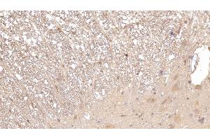 Detection of APOE in Rat Spinal cord Tissue using Monoclonal Antibody to Apolipoprotein E (APOE)