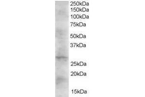 Western Blotting (WB) image for Dickkopf 2 Homolog (DKK2) peptide (ABIN368774) (Dickkopf 2 Homolog (DKK2) Peptide)