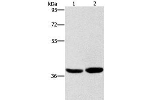 Western Blot analysis of Human fetal brain tissue and 231 cell using CAB39L Polyclonal Antibody at dilution of 1:400 (CAB39L antibody)
