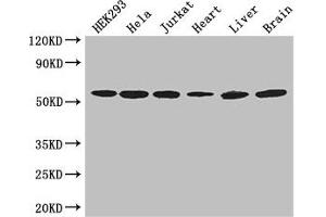 Western Blot Positive WB detected in: HEK293 whole cell lysate, Hela whole cell lysate, Jurkat whole cell lysate, Mouse heart tissue, Mouse liver tissue, Mouse brain tissue All lanes: ARIH2 antibody at 3 μg/mL Secondary Goat polyclonal to rabbit IgG at 1/50000 dilution Predicted band size: 58 kDa Observed band size: 58 kDa (ARIH2 antibody  (AA 43-360))