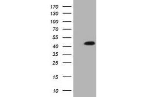 Western Blotting (WB) image for anti-Isovaleryl-CoA Dehydrogenase (IVD) antibody (ABIN1498919)