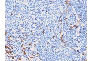 Immunohistochemistry (IHC) image for anti-CD163 (CD163) (AA 43-196) antibody (ABIN6941115)