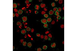 Immunofluorescence (IF) image for anti-CD6 (CD6) antibody (ABIN6941064)
