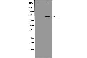 Western blot analysis of Hela whole cell lysates, using MCM3 Antibody. (MCM3 antibody  (N-Term))