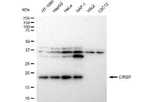 Western blotting analysis using CIRBP antibody (ABIN7798120).