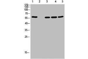 Western Blot analysis of 1,mouse-lung 2,mouse-spleen 3,mouse-kidney 4,mouse-heart 5,293 cells using primary antibody diluted at 1:500(4 °C overnight).