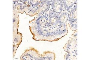 Immunohistochemistry of paraffin embedded mouse duodenum using ADCY4 (ABIN7072959) at dilution of 1: 700 (400x lens) (ADCY4 antibody)
