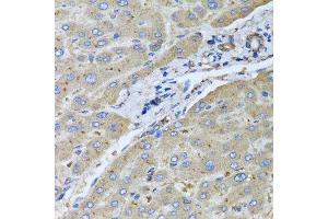 Immunohistochemistry of paraffin-embedded human liver injury using UGT2B10 antibody at dilution of 1:100 (x40 lens). (UGT2B10 antibody)