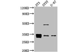 Western Blot Positive WB detected in: NIH/3T3 whole cell lysate, SH-SY5Y whole cell lysate, U-87 whole cell lysate All lanes: Cyclin D1 antibody at 1:1000 Secondary Goat polyclonal to rabbit IgG at 1/50000 dilution Predicted band size: 34 kDa Observed band size: 34 kDa (Recombinant Cyclin D1 antibody)