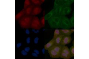 USP21 Mouse Monoclonal Antibody staining Hela cells by IF/ICC.