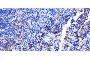 Immunohistochemistry of paraffin-embedded Mouse spleen using CD68 Polyclonal Antibody at dilution of 1:100 (40x lens). (CD68 antibody)