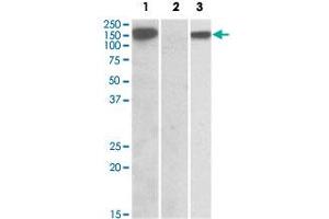 HEK293 lysate (10 ug protein in RIPA buffer) overexpressing human NLRP2 with DYKDDDDK tag probed with NLRP2 polyclonal antibody  (1 ug/mL) in Lane 1 and probed with anti- DYKDDDDK Tag (1/5000) in lane 3. (NLRP2 antibody  (C-Term))