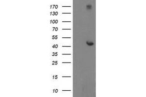 HEK293T cells were transfected with the pCMV6-ENTRY control (Left lane) or pCMV6-ENTRY AP2M1 (Right lane) cDNA for 48 hrs and lysed. (AP2M1 antibody  (AA 97-383))