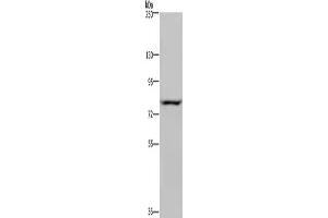 Gel: 6 % SDS-PAGE, Lysate: 40 μg, Lane: Hela cells, Primary antibody: ABIN7130441(NOC2L Antibody) at dilution 1/200, Secondary antibody: Goat anti rabbit IgG at 1/8000 dilution, Exposure time: 5 seconds (NOC2L antibody)