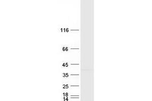 Validation with Western Blot (RHBDD1 Protein (Myc-DYKDDDDK Tag))