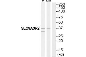 Western blot analysis of extracts from JK cells and K562 cells, using SLC9A3R2 antibody. (SLC9A3R2 antibody  (N-Term))