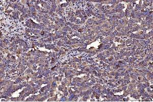 IHC analysis of PDIA6 using anti-PDIA6 antibody (ABIN7600554). (PDIA6 antibody  (AA 20-440))