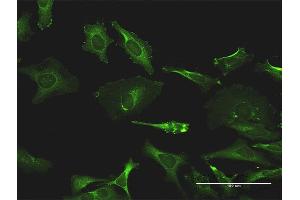 Immunofluorescence of monoclonal antibody to TXK on HeLa cell. (TXK antibody  (AA 131-230))