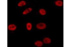 ABIN6275693 staining Hela by IF/ICC. (ZNF592 antibody  (Internal Region))