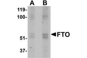 Western blot analysis of FTO in human uterus tissue lysate with AP30350PU-N FTO antibody at (A) 1 and (B) 2 μg/ml. (FTO antibody  (N-Term))