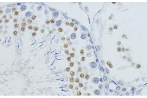 Immunohistochemistry of paraffin-embedded Rat testis using MonoMethyl-Histone H4-K20 Polyclonal Antibody at dilution of 1:200 (40x lens). (Histone H4 antibody  (meLys20))